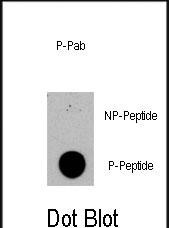 Rabbit Polyclonal Antibody to Phospho-TSC2(S1420)