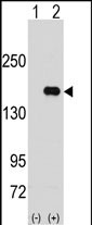 Rabbit Polyclonal Antibody to PUM2 (N-term)