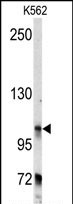 Rabbit Polyclonal Antibody to BICD2