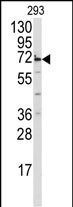 Rabbit Polyclonal Antibody to MIPEP