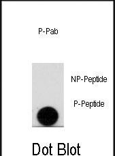 Rabbit Polyclonal Antibody to Phospho-LEO1(S10)