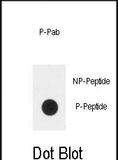 Rabbit Polyclonal Antibody to Phospho-PLXND1(Y1642)