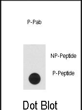 Rabbit Polyclonal Antibody to Phospho-CLASP1(T656)