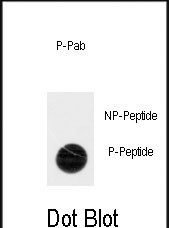 Rabbit Polyclonal Antibody to Phospho-ACK1(Y518)