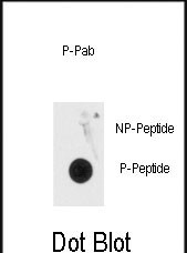 Rabbit Polyclonal Antibody to Phospho-MeCP2(S80)