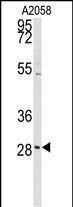 Rabbit Polyclonal Antibody to PRKCDBP