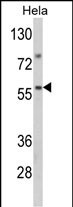 Rabbit Polyclonal Antibody to SARS2