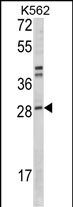 Rabbit Polyclonal Antibody to ITGB1BP3 (N-term)