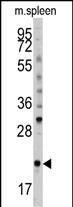 Rabbit Polyclonal Antibody to mouse BID (S61)