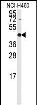 Rabbit Polyclonal Antibody to RMND5B