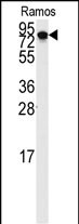Rabbit Polyclonal Antibody to DLG7 (N-term)