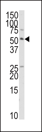 Rabbit Polyclonal Antibody to TRAIP