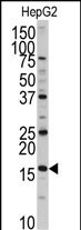 Rabbit Polyclonal Antibody to XTP3TPA (N-term)