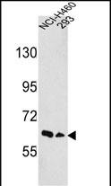 Rabbit Polyclonal Antibody to EphA3 (N-term)