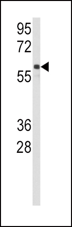 Rabbit Polyclonal Antibody to CYP2C9 (N-term)