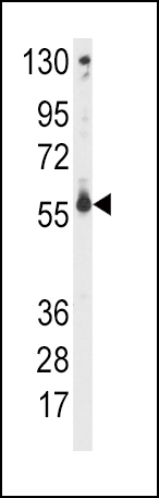 Rabbit Polyclonal Antibody to CYP2C9