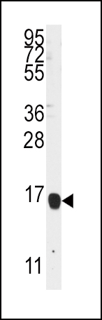 Rabbit Polyclonal Antibody to ALOX5AP