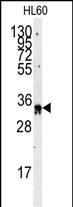 Rabbit Polyclonal Antibody to EXOSC8