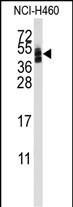 Rabbit Polyclonal Antibody to CXADR