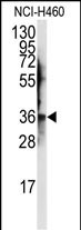 Rabbit Polyclonal Antibody to JTV1