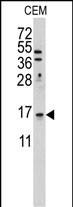 Rabbit Polyclonal Antibody to LSM1
