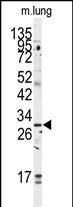 Rabbit Polyclonal Antibody to GOLPH3