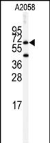 Rabbit Polyclonal Antibody to BCHE