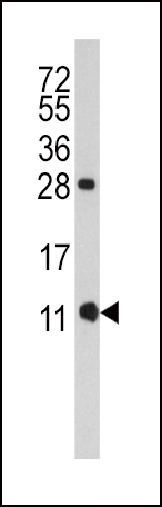 Rabbit Polyclonal Antibody to FKBP1B (N-term E6)