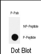 Rabbit Polyclonal Antibody to Phospho-HIPK2(Y361)