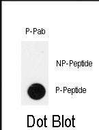 Rabbit Polyclonal Antibody to Phospho-IPF(T11)
