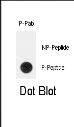 Rabbit Polyclonal Antibody to Phospho-TERT(Y707)