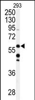 Rabbit Polyclonal Antibody to CABC1 (C-term D531)
