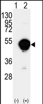 Rabbit Polyclonal Antibody to CYP20A1