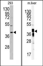 Rabbit Polyclonal Antibody to AKR7A2 (N-term)