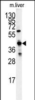 Rabbit Polyclonal Antibody to GCAT