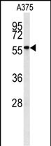 Rabbit Polyclonal Antibody to NAB2