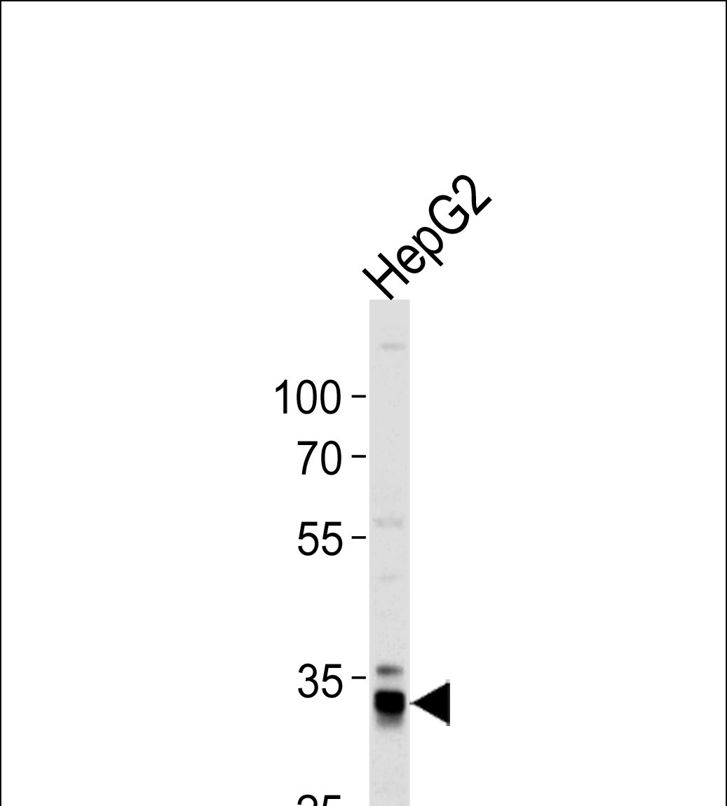Rabbit Polyclonal Antibody to MPST (N-term)