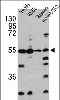 Rabbit Polyclonal Antibody to CASP2