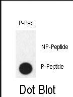 Rabbit Polyclonal Antibody to Phospho-PHB2(Y248)
