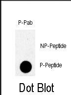 Rabbit Polyclonal Antibody to Phospho-TBK(S172)