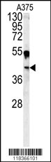 Rabbit Polyclonal Antibody to CA14 (N-term)