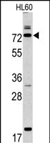 Rabbit Polyclonal Antibody to CAPN9 (N-term)