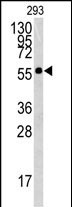 Rabbit Polyclonal Antibody to BTBD1