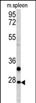 Rabbit Polyclonal Antibody to PTHLH