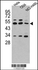 Rabbit Polyclonal Antibody to CPA4