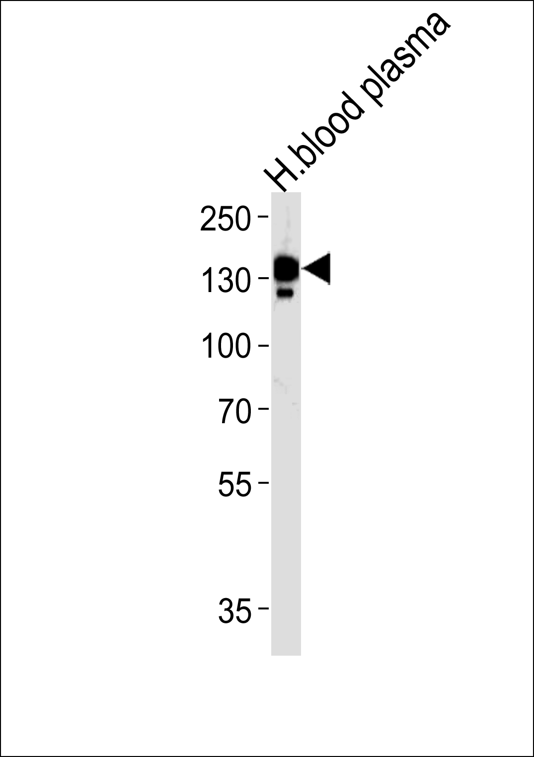 Rabbit Polyclonal Antibody to CP (N-term)