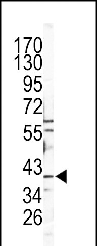 Rabbit Polyclonal Antibody to CATB