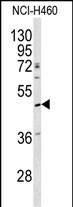 Rabbit Polyclonal Antibody to SERPINA4