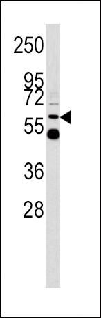 Rabbit Polyclonal Antibody to UDB17