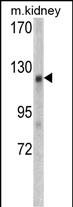 Rabbit Polyclonal Antibody to WTX
